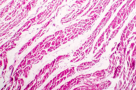 Brown atrophy of the heart, light micrograph, photo under microscopeの写真素材