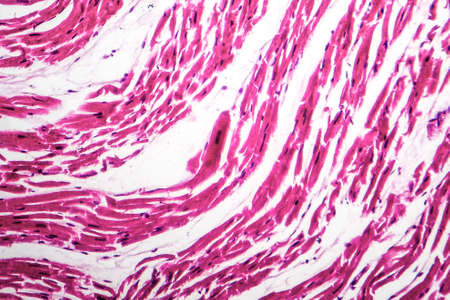Brown atrophy of the heart, light micrograph, photo under microscopeの写真素材