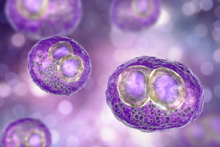 Cytomegalovirus CMV in human cell, owls eye inclusion in nucleus, multinucleated cell, 3D illustration. It is herpes virus, causes disease in fetus, organ transplant patients, HIV infected peopleの写真素材