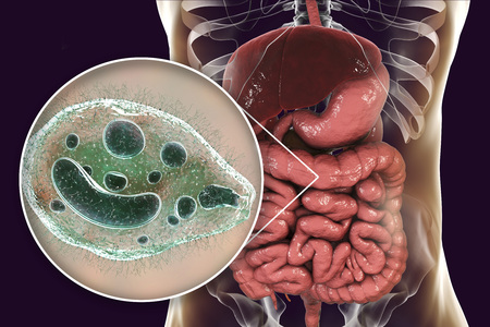 Balantidium coli protozoan in large intestine, 3D illustration. Ciliated intestinal parasite that...