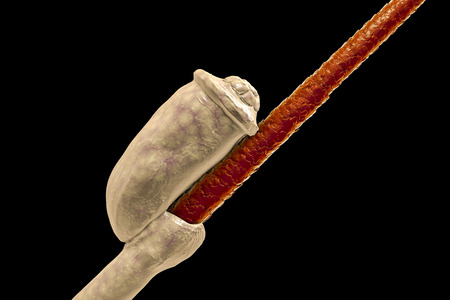 Human head louse nit on hair, Pediculus humanus capitis, 3D illustration