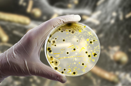 Colonies of different bacteria and mold fungi on Petri dish with nutrient agar on the bacterial...