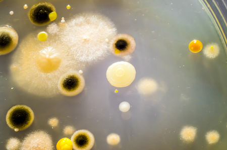 Colonies of different bacteria and mold fungi grown on Petri dish with nutrient agar, close-up view. Microbiology backgroundの写真素材