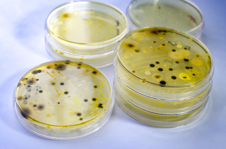 Colonies of different bacteria and mold fungi grown on Petri dish with nutrient agar, close-up view. Microbiology backgroundの写真素材