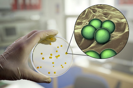 Colonies of Micrococcus luteus bacteria on agar plate and close up view of micrococci bacteria,...