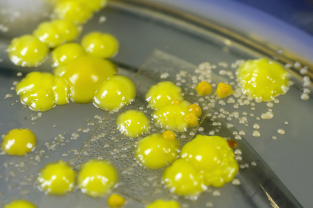 Bacteria grown from skin smear, colonies of Micrococcus luteus and Staphylococcus epidermidis on...