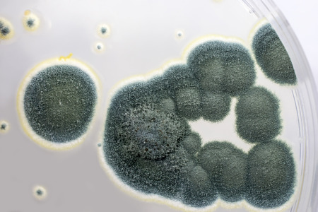 Colonies of Penicillium fungi grown on Sabouraud Dextrose Agar. Penicillium is a mold fungus that...