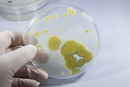 Colonies of Penicillium fungi grown on Sabouraud Dextrose Agar, photo showing yellow reverse side....