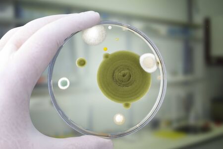 Colonies of different mold fungi grown from indoor air on Petri dish with Sabourad dextrose agar, close-up view. Hand in white glove holding plate with microbes in research laboratoryの写真素材