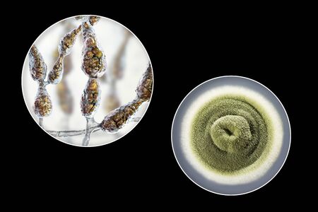 Mold Alternaria alternata, allergic fungus, 3D illustration and photo of colony on agar plate....