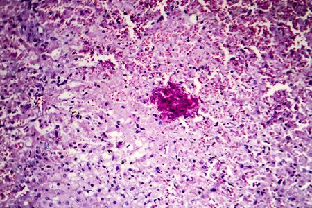 Hepatic congestion, light micrograph, photo under microscopeの写真素材