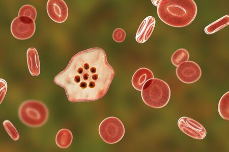 The malaria-infected red blood cell. 3D illustration showing malaria parasite Plasmodium ovale in the stage of ring-form trophozoiteの写真素材