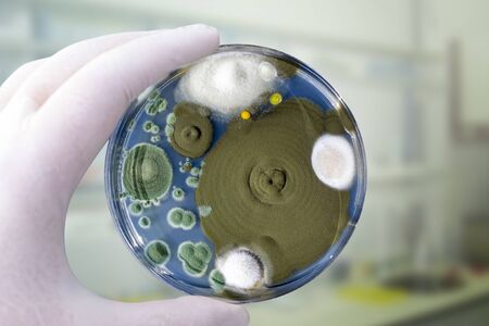 Colonies of different mold fungi grown from indoor air on Petri dish with Sabourad dextrose agar, close-up view. Hand in white glove holding plate with microbes in research laboratoryの写真素材
