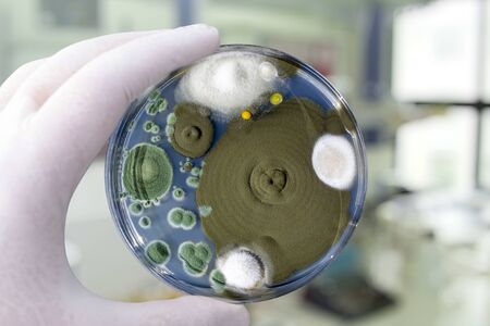 Colonies of different mold fungi grown from indoor air on Petri dish with Sabourad dextrose agar, close-up view. Hand in white glove holding plate with microbes in research laboratoryの写真素材