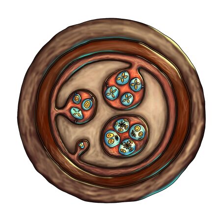 Structure of hydatid cyst of Echinococcus granulosus, illustration. Echinococcus is a parasitic worm...