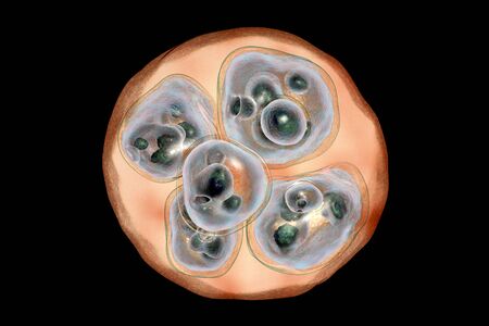 Structure of hydatid cyst of Echinococcus multilocularis, 3D illustration. E. multilocularis is a...