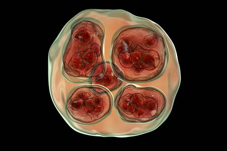 Structure of hydatid cyst of Echinococcus multilocularis, 3D illustration. E. multilocularis is a...
