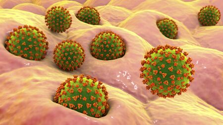Coronaviruses SARS-CoV-2 infecting human alveoli cells, the concept of COVID-19 spread and infection...