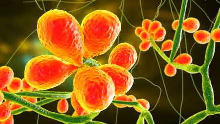 Fungus Sporothrix schenckii, the causative agent of sporotrichosis, especially common in florists...