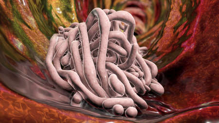 Parasitic worms in the lumen of intestine, 3D illustration. Ascaris lumbricoides and other round...