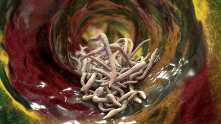 Parasitic worms in intestine