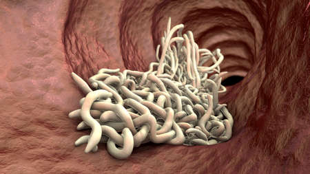 Parasitic worms in the lumen of intestine, 3D illustration. Ascaris lumbricoides and other round...