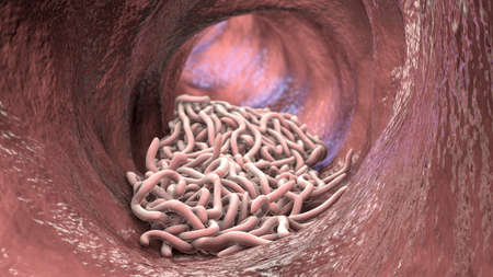 Parasitic worms in the lumen of intestine, 3D illustration. Ascaris lumbricoides, Enterobius...