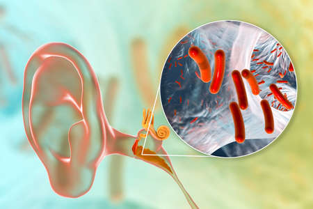 Otitis media, inflammatory disease of the middle ear