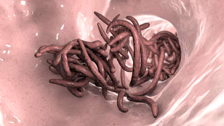 Parasitic worms in the lumen of intestine, 3D illustration. Ascaris lumbricoides, Enterobius vermicularis, and other round wormsの写真素材