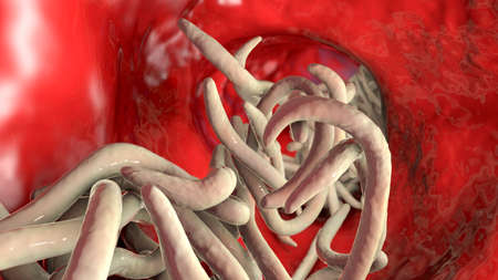 Parasitic worms in the lumen of intestine, 3D illustration. Ascaris lumbricoides, Enterobius...