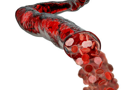 Blood flowing from the damaged blood vessel, hemorrhage, 3D illustrationの写真素材