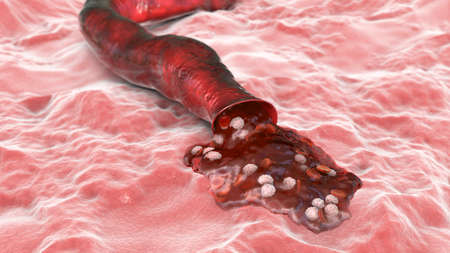 Blood flowing from the damaged blood vessel, hemorrhage, 3D illustration
