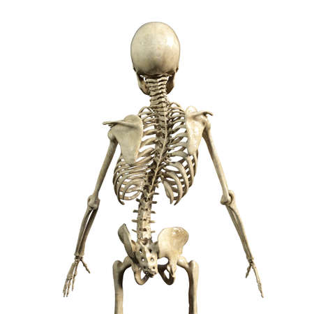 Anatomy of scoliosis, spinal deformity, 3D illustrationの写真素材