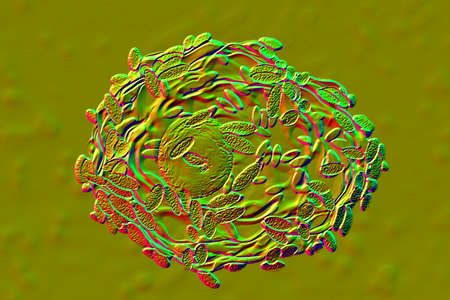Bacterial vaginosis. 3D illustrations showing epithelial cells covered with bacteria Gardnerella...