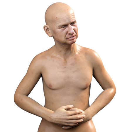 Abdominal pain, conceptual 3D illustration. A male person suffering from stomach pain isolated on...