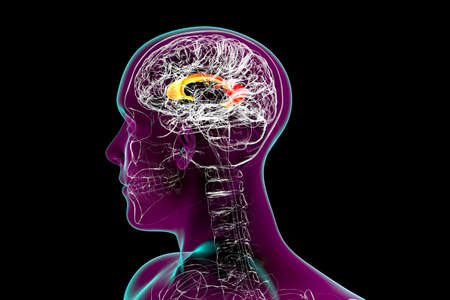 Corpus callosum, also known as callosal commissure, highlighted in human brain, 3D illustration. It is a wide, thick nerve tract connecting the left and right cerebral hemispheresの写真素材
