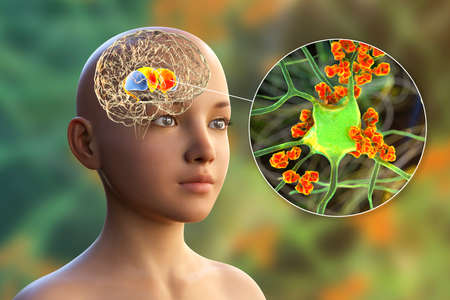 Anti-neuronal antibodies, anti-basal ganglia antibodies. 3D illustration shows immunoglobulins...