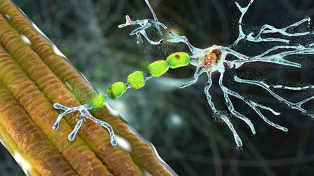 Degradation of motor neurons, conceptual 3D illustration. Motor neuron diseases are a group of...