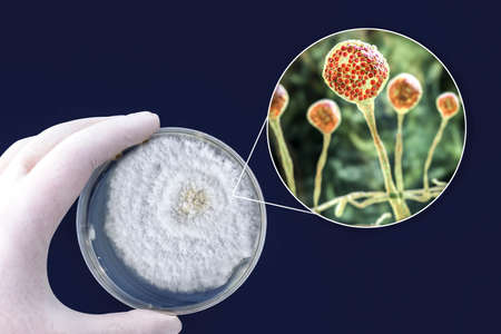 Colony of Mucor fungi grown in laboratory on Petri dish. Also known as black fungus and yellow...