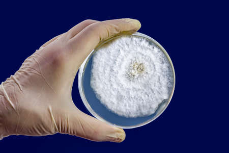 Colony of Mucor fungi grown in laboratory on Petri dish. Also known as black fungus, or bread mold,...