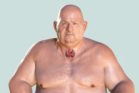 Thyroid gland highlighted in obese man, 3D illustration. Concept of obesity and inner organs...