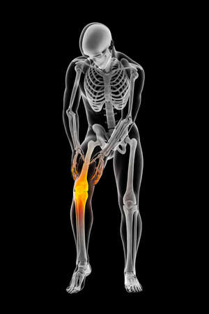 Painful knee, anatomy and medicine concept, 3D illustrationの写真素材