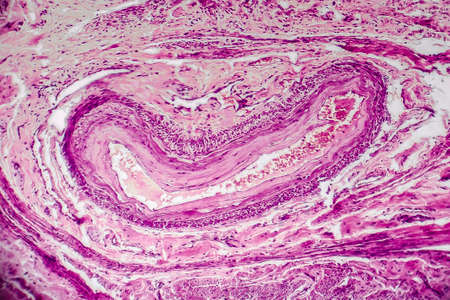 Cross-section of a blood vessel from cervix uteri with red blood cells, light micrograph, photo under microscopeの写真素材