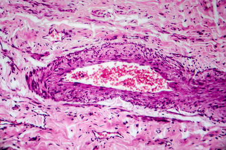 Cross-section of a blood vessel with red blood cells, light micrograph, photo under microscope