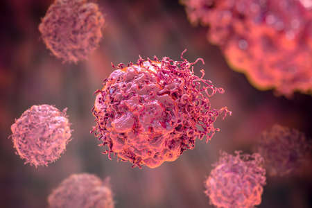 Cancer cells, malignant cells, scientific 3D illustrationの写真素材