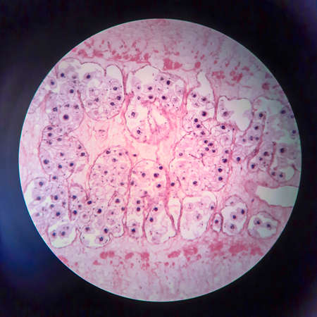 Pork tapeworm Taenia solium, section through the body, light micrographの写真素材