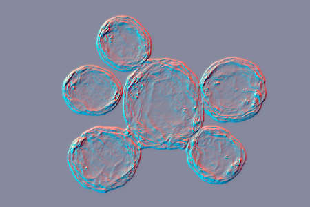 Fungi Paracoccidioides lutzii, a dimorphic fungus that causes paracoccidioidomycosis found in Brazil...