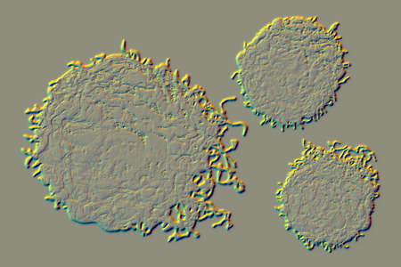 Cancer cells, malignant cells, scientific 3D illustration