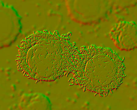 Cancer cells, malignant cells, scientific 3D illustrationの写真素材