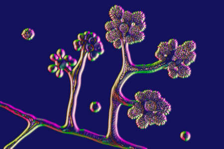 Microscopic fungi Cunninghamella, scientific 3D illustration. Pathogenic fungi from the order Mucorales, cause sinopulmonary and disseminated infections, one of the causative agents of mucormycosisの写真素材